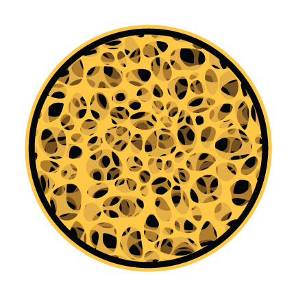 Cross-section of healthy, dense bone with a thick lattice